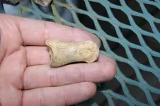 metacarpal2.webp