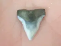 tooth 1.webp tooth 1.webp