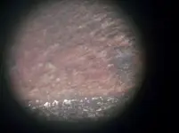 VDBzoom.webp
