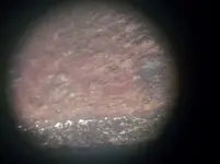 VDBzoom2.webp