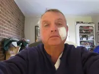 6 stitches.webp