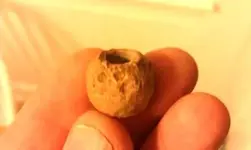 IMAG0565musketball.webp