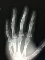 hand.webp