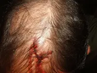 headcut.webp