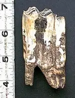 tooth1.webp