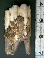tooth2.webp