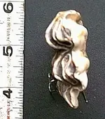 tooth3.webp