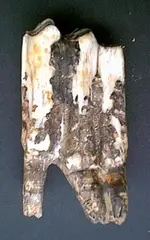tooth6.webp