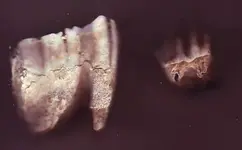 teeth.webp