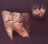 teeth2.webp