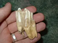 tooth.webp