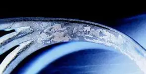 Ring Ster_4370.webp