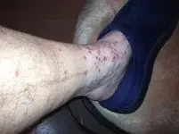 foot.webp