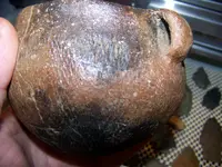 100_3995.webp