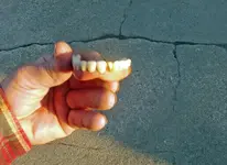 goldtooth.webp