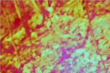 backyard strange hit area 3.webp