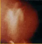 campfire02.webp