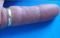 Pinky FInger Ring Not.webp