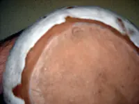 pot3.webp
