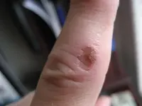 finger (Large).webp