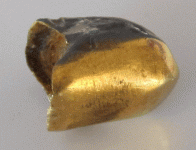 tooth.gif