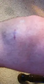 knee.webp