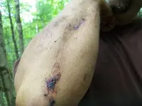 bee injury1.webp