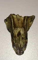 tooth4.webp