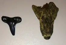 tooth2.webp
