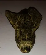 tooth7.webp