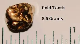 tooth.webp