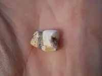 tooth.webp tooth.webp