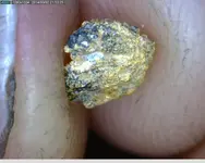 microgold3.webp