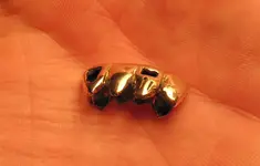 Teeth.webp Teeth.webp