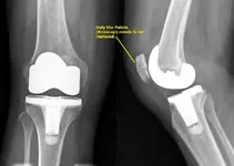 Knee Joint.webp