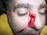 holeinhead.webp