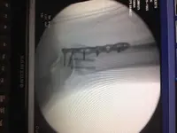 xray.webp