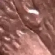 enamel7