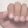 Dirty Nails