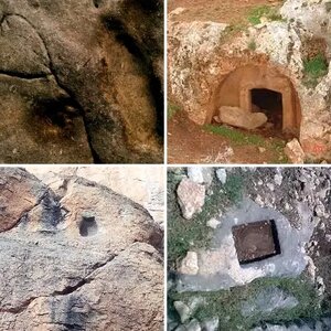 Signs and Symptoms of Grave