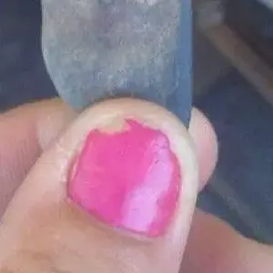 2nd view of possible tooth