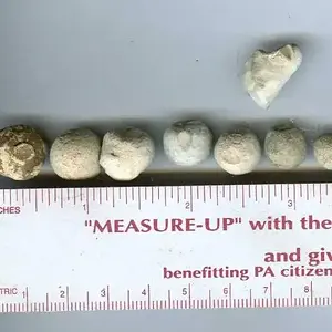 Musketballs