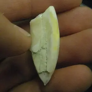 Tooth