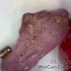 Garnet magnified 150x