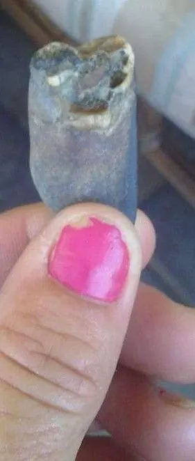 2nd view of possible tooth