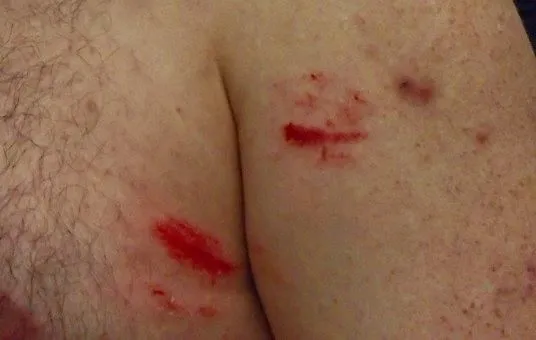 CZ21 SAVED MY LIFE - OR AT LEAST A TRIP TO THE HOSPITAL - WAS ON A LARGE RELIC HUNT AND DECIDED TO TRY MY WATER MACHINE ON LAND - IT PERFORMED GREAT -