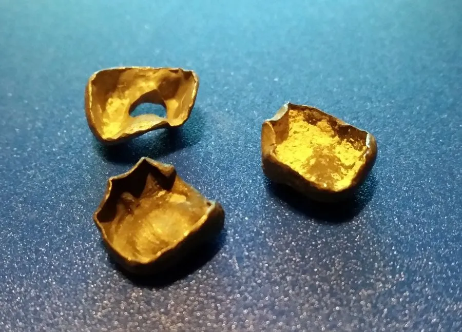 Gold Fillings/Crowns, Chiefland, Florida.