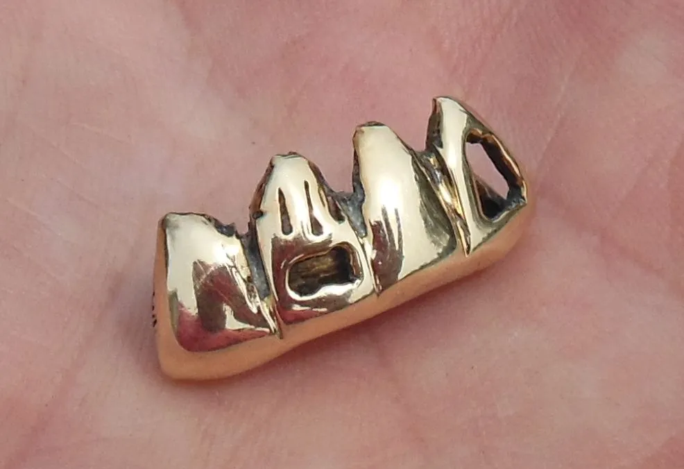 Gold Teeth